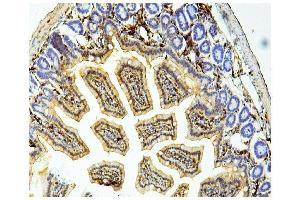 IHC analysis of Galectin 3/LGALS3 using anti Galectin 3/LGALS3 antibody (ABIN6719486).