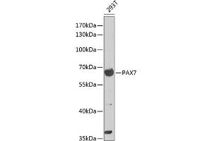 Western blot analysis of extracts of 293T cells, using P antibody (ABIN6132463, ABIN6145262, ABIN6145264 and ABIN6216484) at 1:1000 dilution. (PAX7 antibody  (AA 289-518))