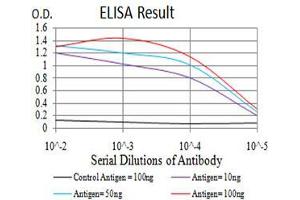 ELISA image for anti-Histone Deacetylase 4 (HDAC4) (AA 456-592) antibody (ABIN5542326)