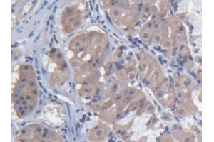 DAB staining on IHC-P; Samples: Human Stomach Tissue (MARS antibody  (AA 74-198))
