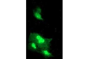 Anti-DTNB mouse monoclonal antibody (ABIN2455578) immunofluorescent staining of COS7 cells transiently transfected by pCMV6-ENTRY DTNB (RC203798). (Dystrobrevin beta antibody)
