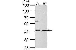 WB Image MPI antibody detects MPI protein by Western blot analysis. (MPI antibody)