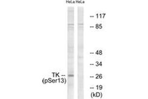 Western blot analysis of extracts from HeLa cells treated with paclitaxel 1uM 24h, using TK (Phospho-Ser13) Antibody. (TK (AA 1-50), (pSer13) antibody)