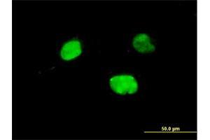 Immunofluorescence of monoclonal antibody to IRX5 on HeLa cell. (IRX5 antibody  (AA 204-264))