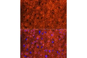 Immunofluorescence analysis of mouse brain using CDK6 antibody (ABIN7266595) at dilution of 1:100.
