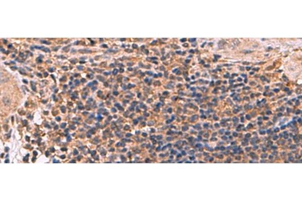 ZBTB33 antibody