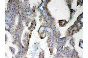 IHC analysis of PAH using anti-PAH antibody . (Phenylalanine Hydroxylase antibody  (AA 71-208))