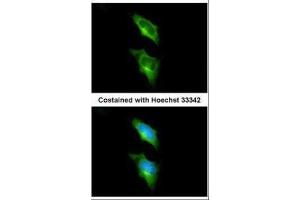 ICC/IF Image Immunofluorescence analysis of methanol-fixed HeLa, using GPR82, antibody at 1:200 dilution.