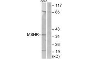 Western blot analysis of extracts from COLO205 cells, using MSHR Antibody. (MC1 Receptor antibody  (AA 268-317))