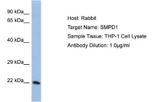 Host: Rabbit Target Name: SMPD1 Sample Tissue: Human THP-1 Whole Cell Antibody Dilution: 1ug/ml (SMPD1 antibody  (Middle Region))