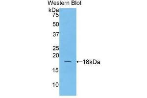 Detection of Recombinant FGF1, Mouse using Polyclonal Antibody to Fibroblast Growth Factor 1, Acidic (FGF1) (FGF1 antibody  (AA 16-155))