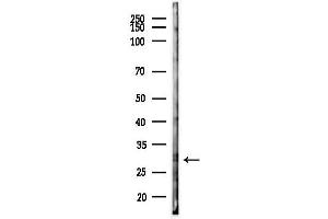 anti-Ring Finger Protein 138 (RNF138) (Internal Region) antibody