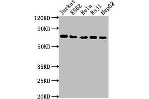 Western Blot Positive WB detected in: Jurkat whole cell lysate, K562 whole cell lysate, Hela whole cell lysate, Raji whole cell lysate, HepG2 whole cell lysate All lanes: FUBP1 antibody at 1:2000 Secondary Goat polyclonal to rabbit IgG at 1/50000 dilution Predicted band size: 68, 69 kDa Observed band size: 69 kDa (Recombinant FUBP1 antibody)