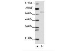 Image no. 1 for anti-Regulatory Factor X 5 (RFX5) (N-Term) antibody (ABIN203226) (RFX5 antibody  (N-Term))
