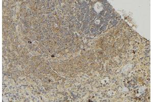 ABIN6272873 at 1/100 staining Human lymph node tissue by IHC-P. (TCTN1 antibody  (N-Term))