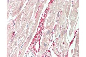 Human Heart: Formalin-Fixed, Paraffin-Embedded (FFPE). (TMLHE antibody  (Biotin))