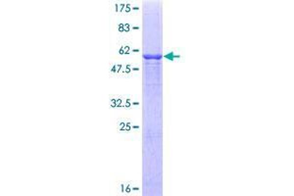 C1QTNF1 Protein (AA 26-281) (GST tag)