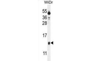 Western Blotting (WB) image for anti-Brain Expressed, X-Linked 1 (BEX1) antibody (ABIN2995790) (BEX1 antibody)