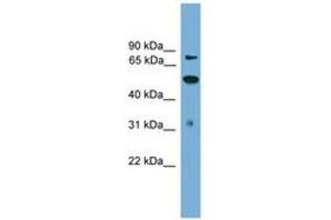 Image no. 1 for anti-Tousled-Like Kinase 2 (TLK2) (AA 35-84) antibody (ABIN6745638) (TLK2 antibody  (AA 35-84))