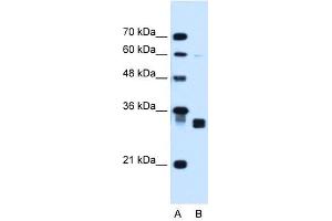 Carbonyl Reductase 1 antibody used at 1. (CBR1 antibody  (C-Term))