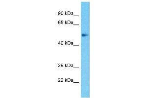 Host:  Rabbit  Target Name:  ZBTB25  Sample Type:  Uterus Tumor lysates  Antibody Dilution:  1. (ZBTB25 antibody  (Middle Region))