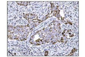 IHC analysis of DLGAP1 using anti-DLGAP1 antibody (ABIN7600257). (DLGAP1 antibody  (AA 17-319))