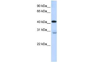 GRAMD2 antibody used at 1 ug/ml to detect target protein.