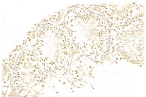 ABIN6265200 and ABIN6269069 at 1/100 staining Rat testis tissue by IHC-P. (SNAIL antibody  (C-Term))