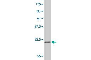 Western Blot detection against Immunogen (34. (SMAD5 antibody  (AA 105-182))