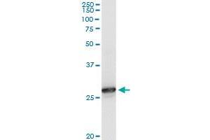 PRDX6 monoclonal antibody (M01), clone 3A10-2A11. (Peroxiredoxin 6 antibody  (AA 1-224))