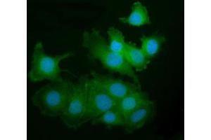 IF analysis of PAK2 using anti-PAK2 antibody (ABIN7599219).