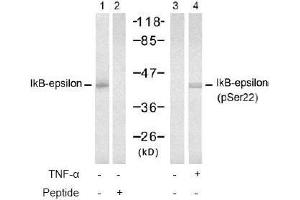 Image no. 2 for anti-Nuclear Factor of kappa Light Polypeptide Gene Enhancer in B-Cells Inhibitor, epsilon (NFKBIE) (pSer22) antibody (ABIN196949) (NFKBIE antibody  (pSer22))