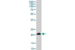 TIMP2 monoclonal antibody (M03), clone 1C3 Western Blot analysis of TIMP2 expression in HeLa . (TIMP2 antibody  (AA 27-220))
