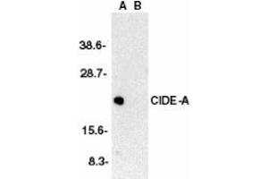 Western blot analysis of CIDE-A in human brain tissue lysate in the absence (A) or presence (B) of peptide with AP30229PU-N CIDE-A antibody at 1/2000 dilution.