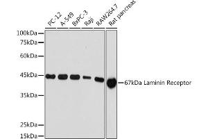 Western blot analysis of extracts of various cell lines, using 67 kDa Laminin Receptor Rabbit mAb (ABIN7270042) at 1:1000 dilution. (RPSA/Laminin Receptor antibody)