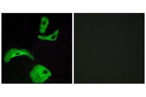 Immunofluorescence analysis of HeLa cells, using GPR18 antibody.