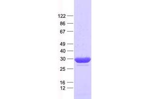 C11orf54 Protein (His tag)