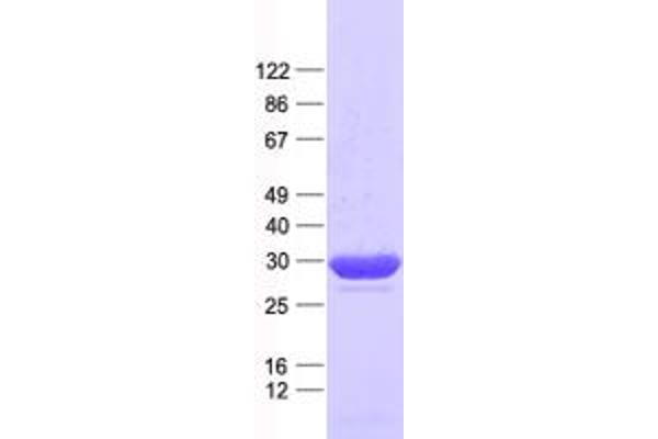 C11orf54 Protein (His tag)