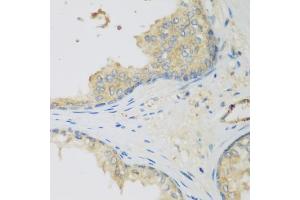 Immunohistochemistry of paraffin-embedded human prostate using LLGL2 antibody (ABIN5975836) at dilution of 1/200 (40x lens). (LLGL2 antibody)