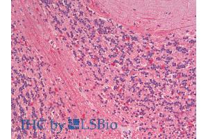 ABIN1590014 (5µg/ml) staining of paraffin embedded Human Cerebellum. (ZNRF1 antibody  (Internal Region))