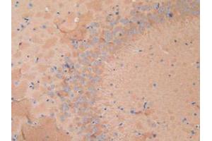 Figure. (Dynamin 1 antibody  (AA 572-745))