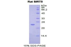 SDS-PAGE analysis of Rat Sirtuin 5 Protein.