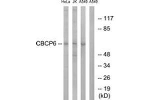 Western blot analysis of extracts from A549/HeLa/Jurkat cells, using AGBL4 Antibody. (AGBL4 antibody  (AA 431-480))
