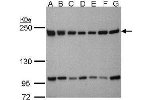 WB Image Sample(30μg whole cell lysate) A: 293T B: A431 , C: H1299 D: HeLa S3 , E: Hep G2 , F: MOLT4 , G: Raji , 5% SDS PAGE antibody diluted at 1:1000 (BTAF1 antibody  (C-Term))