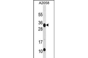 RAET1E Antibody (Center) (ABIN1881724 and ABIN2838636) western blot analysis in  cell line lysates (35 μg/lane). (Retinoic Acid Early Transcript 1E (RAET1E) (AA 150-179) antibody)