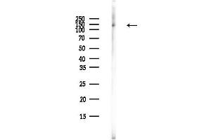Western blot analysis of lysates from COLO205 cells(heat-shock,45 min treatment), using Phospho-MSH6 (Ser14) Antibody at 1/1000 dilution.