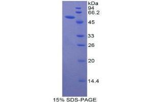 SDS-PAGE (SDS) image for Vitamin K-dependent protein C (PROC) (AA 197-436) protein (His tag,GST tag) (ABIN2123532) (PROC Protein (AA 197-436) (His tag,GST tag))