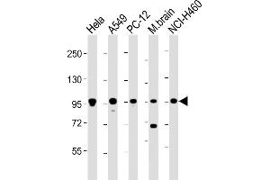 All lanes : Anti-PCSK1 Antibody (C-Term) at 1:2000 dilution Lane 1: Hela whole cell lysate Lane 2: A549 whole cell lysate Lane 3: PC-12 whole cell lysate Lane 4: mouse brain lysate Lane 5: NCI- whole cell lysate Lysates/proteins at 20 μg per lane. (PCSK1 antibody  (AA 682-715))