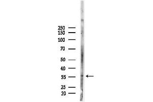 anti-Coenzyme Q9 Homolog (COQ9) (Internal Region) antibody