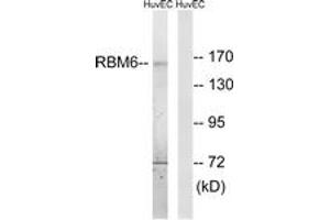Western blot analysis of extracts from HuvEc cells, using RBM6 Antibody. (RBM6 antibody  (AA 991-1040))